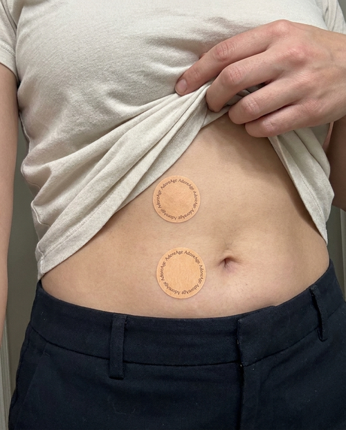 Collagen Patches